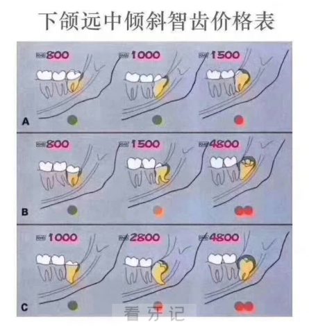 拔智齿要2000多我是不是被坑了附拔智齿价格表