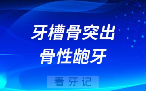 如何判断自己到底是牙槽骨突出还是骨性龅牙附自测攻略
