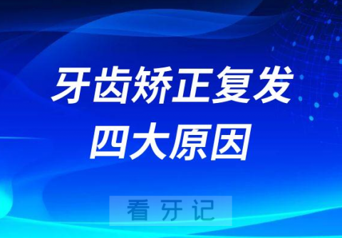 牙齿矫正反弹复发失败四大原因