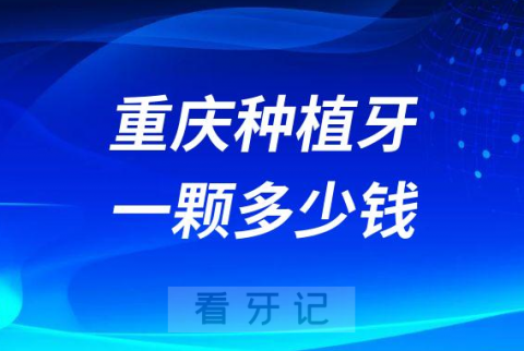 重庆种植牙多少钱一颗附2022-2023价格表