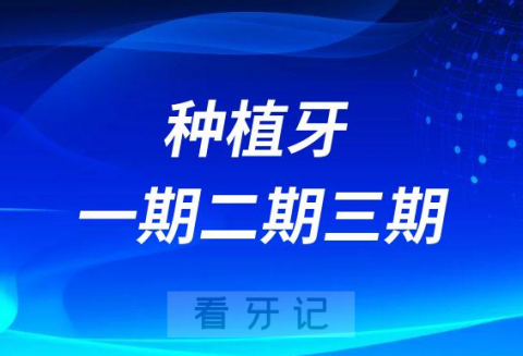 种植牙一期二期三期各需要多久附详细流程