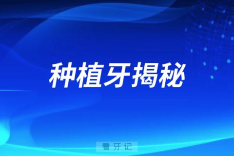 种植牙为什么能和人牙槽骨成功长在一起