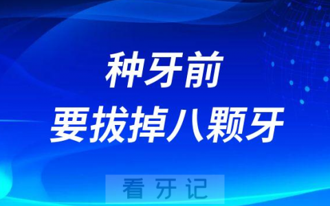 崩溃了种牙前要拔掉8颗牙分享我的种植牙经历和体会