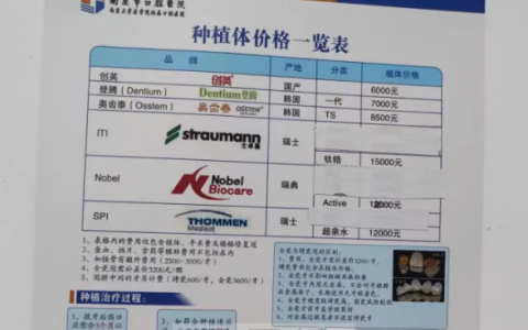 ****种植牙价格一览表