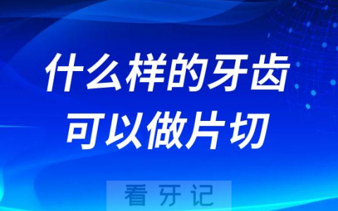什么样的牙齿可以做正畸片切附五大类型