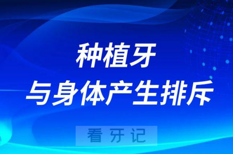 种植牙会不会与身体产生排斥