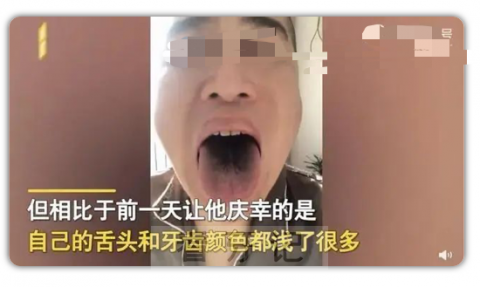 阳了之后舌头牙齿全变黑