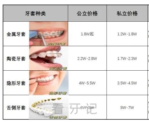 023年做牙齿矫正价格及选择公立还是私立医院"