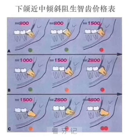 拔智齿要2000多我是不是被坑了附拔智齿价格表