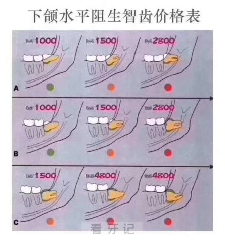 拔智齿要2000多我是不是被坑了附拔智齿价格表