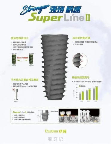 登腾种植牙五大优点