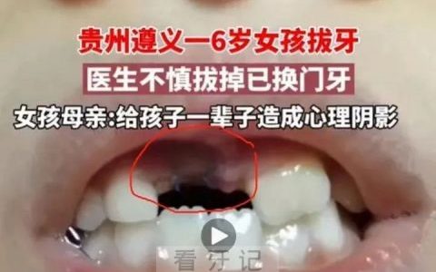 太可怕了牙医竟然给孩子拔错牙一辈子的阴影