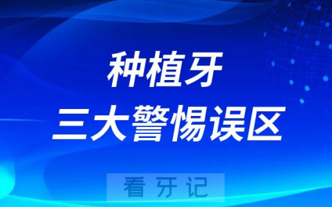 种植牙三大警惕误区