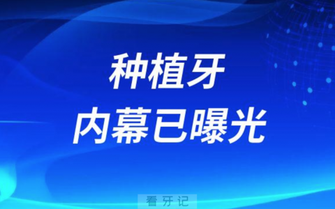 种植牙内幕已曝光低价种植牙是陷阱