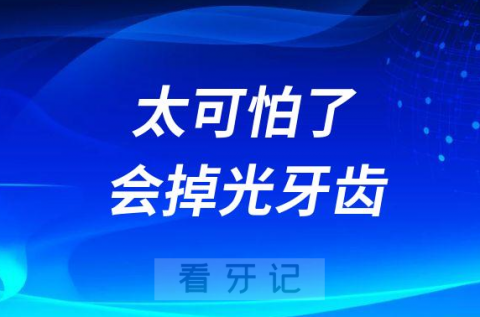 太可怕了这种牙病不治疗会掉光牙齿