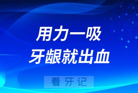 阳了太可怕了为什么用力一吸牙龈就出血