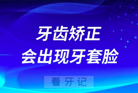 太可怕了牙齿矫正会出现牙套脸是不是真的