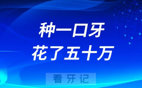 种一口牙多少钱有人竟然花了50万是真的假的