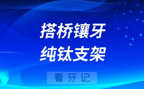 hpp搭桥镶牙纯钛支架哪个最适合老年人价格贵不贵