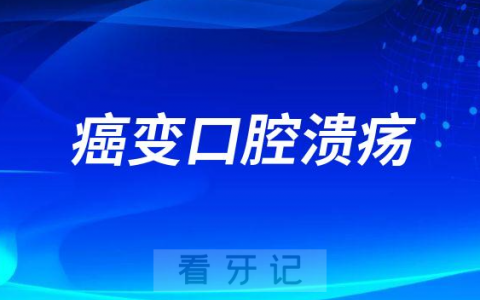 癌变风险高口腔溃疡长在哪里附五大症状