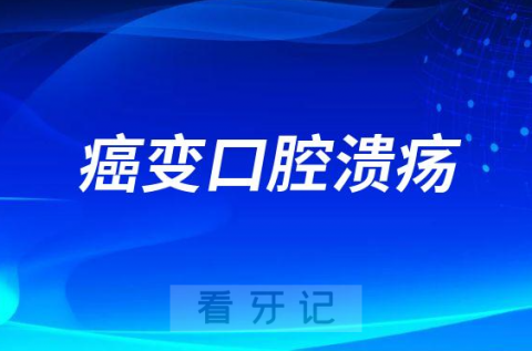 癌变风险高口腔溃疡长在哪里附五大症状