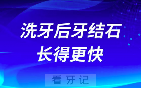 洗牙后牙结石长得更快是真的假的