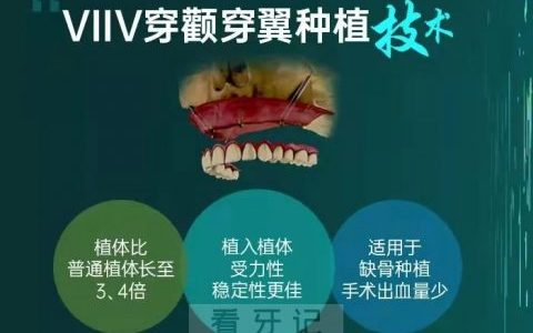 徐州医大鼎植口腔医院做种植牙怎么样