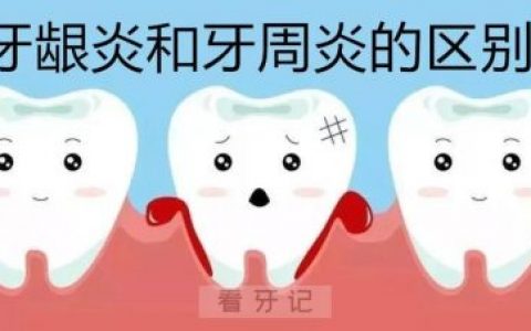 牙龈炎牙周炎四大区别