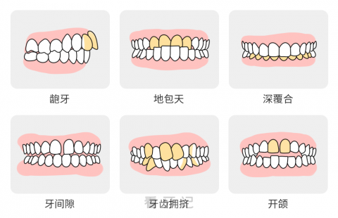 牙齿矫正免费定检公益项目启动