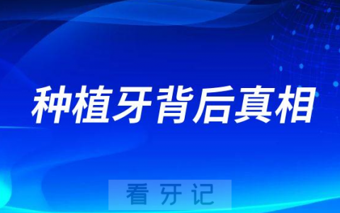 公立牙医给你揭秘种植牙背后真相