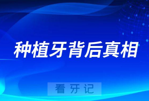 公立牙医给你揭秘种植牙背后真相