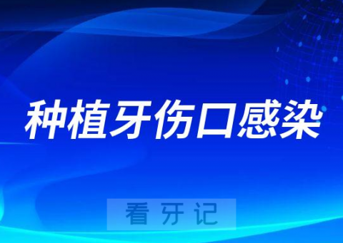 种植牙伤口感染导致失败原因整理