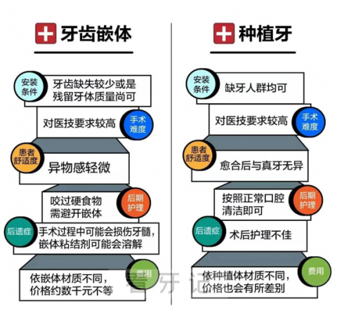 四大牙齿修复方式