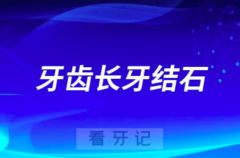 牙齿老是容易长牙结石怎么办