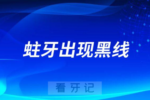 蛀牙出现黑线不疼要不要补牙