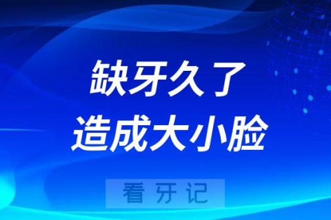 缺牙久了会造成大小脸是不是真的