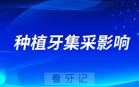 种植牙集采对公立医院医生收入变化大不大