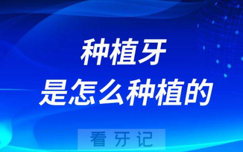 种植牙是怎么种植的附四大流程