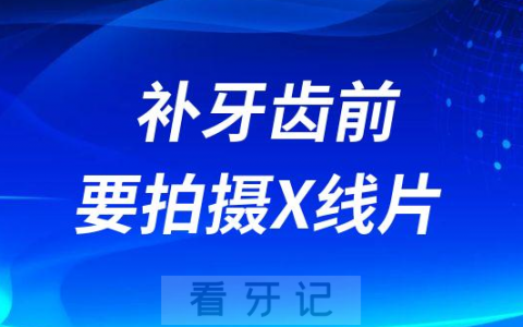 补牙齿为什么要拍摄X线片有没有危害