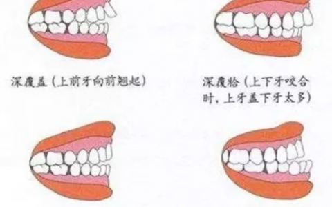 太可怕了牙齿畸形一定要尽早治疗