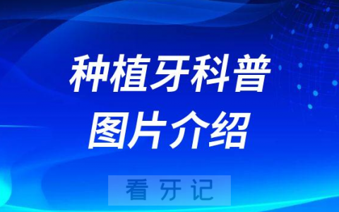 种植牙是什么种植牙好吗种植牙图片介绍