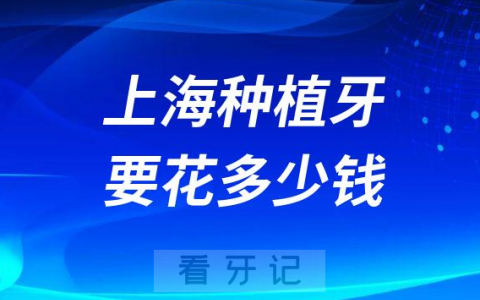 2023年在上海种植牙要花多少钱