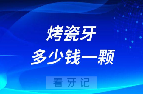 烤瓷牙多少钱一颗2023年收费明细曝光