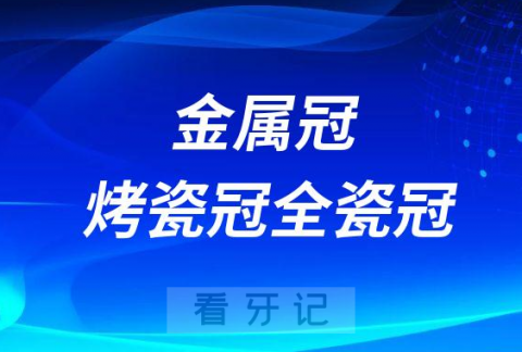 金属冠烤瓷冠全瓷冠哪种最好如何选择