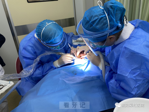 咸阳彩虹医院口腔科完成首例种植导板种植牙手术