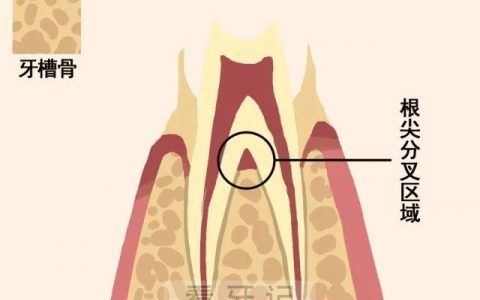 牙槽骨吸收症状有哪些具体表现