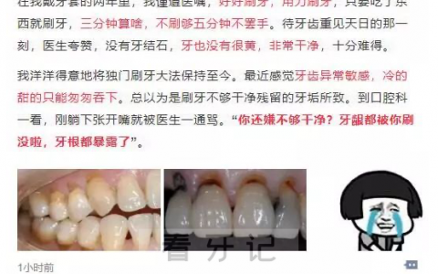太可怕了杭州姑娘刷坏了22颗牙全要补