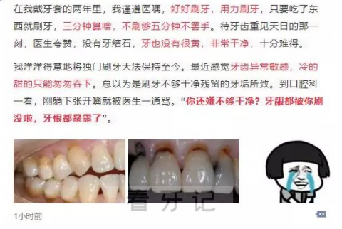 太可怕了杭州姑娘刷坏了22颗牙全要补