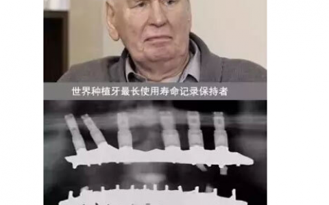 种植牙世界记录保持者 Sven Johansson 还活着吗？