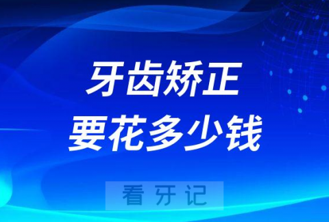 牙齿矫正要花多少钱2023年最新版价格表